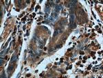 Annexin A1 Antibody in Immunohistochemistry (Paraffin) (IHC (P))