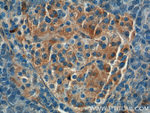 Annexin A1 Antibody in Immunohistochemistry (Paraffin) (IHC (P))