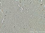 VDAC1/Porin Antibody in Immunohistochemistry (Paraffin) (IHC (P))