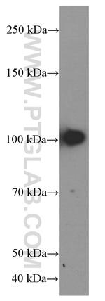 TLR4 Antibody in Western Blot (WB)