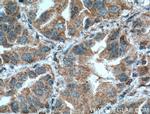 COX2/ Cyclooxygenase 2 Antibody in Immunohistochemistry (Paraffin) (IHC (P))