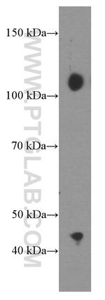 CBLB Antibody in Western Blot (WB)