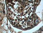 CBLB Antibody in Immunohistochemistry (Paraffin) (IHC (P))