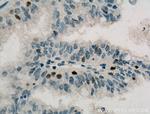 Cyclin D3 Antibody in Immunohistochemistry (Paraffin) (IHC (P))