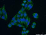 ACTH Antibody in Immunocytochemistry (ICC/IF)