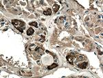 ACTH Antibody in Immunohistochemistry (Paraffin) (IHC (P))