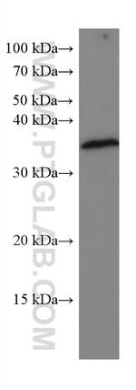 ACTH Antibody in Western Blot (WB)