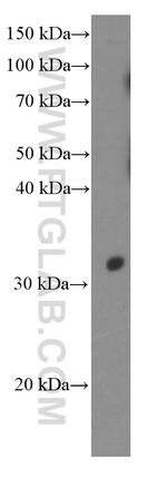 ACTH Antibody in Western Blot (WB)