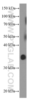 ACTH Antibody in Western Blot (WB)