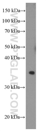 ACTH Antibody in Western Blot (WB)