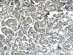 NUP155 Antibody in Immunohistochemistry (Paraffin) (IHC (P))