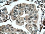 NUP155 Antibody in Immunohistochemistry (Paraffin) (IHC (P))