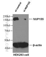 NUP155 Antibody in Western Blot (WB)