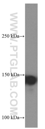 NUP155 Antibody in Western Blot (WB)