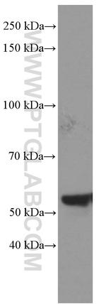 NONO Antibody in Western Blot (WB)