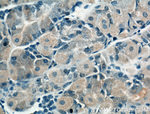 CHRNA5 Antibody in Immunohistochemistry (Paraffin) (IHC (P))