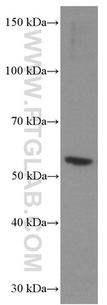 CHRNA5 Antibody in Western Blot (WB)