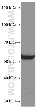 CHRNA5 Antibody in Western Blot (WB)