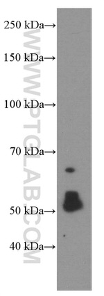 CHRNA5 Antibody in Western Blot (WB)