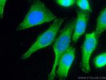 D2HGDH Antibody in Immunocytochemistry (ICC/IF)