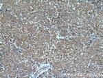 D2HGDH Antibody in Immunohistochemistry (Paraffin) (IHC (P))