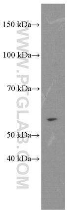 D2HGDH Antibody in Western Blot (WB)