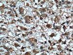 MMP2 Antibody in Immunohistochemistry (Paraffin) (IHC (P))