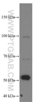 MMP2 Antibody in Western Blot (WB)