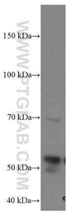 MMP2 Antibody in Western Blot (WB)