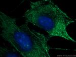 SKAP2 Antibody in Immunocytochemistry (ICC/IF)