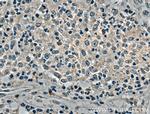 SKAP2 Antibody in Immunohistochemistry (Paraffin) (IHC (P))