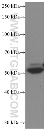 SKAP2 Antibody in Western Blot (WB)