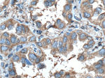 PGRMC1 Antibody in Immunohistochemistry (Paraffin) (IHC (P))