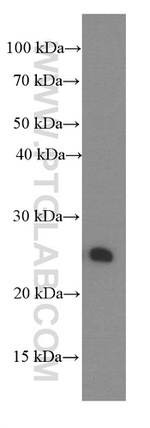 PGRMC1 Antibody in Western Blot (WB)