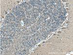 TUBB3 Antibody in Immunohistochemistry (Paraffin) (IHC (P))