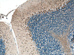 TUBB3 Antibody in Immunohistochemistry (Paraffin) (IHC (P))