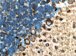 TUBB3 Antibody in Immunohistochemistry (Paraffin) (IHC (P))