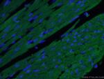 Cardiac Troponin I Antibody in Immunohistochemistry (PFA fixed) (IHC (PFA))