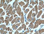 Cardiac Troponin I Antibody in Immunohistochemistry (Paraffin) (IHC (P))