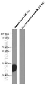 Cardiac Troponin I Antibody in Western Blot (WB)