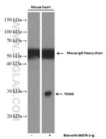 Cardiac Troponin I Antibody in Western Blot (WB)