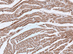 Cardiac Troponin I Antibody in Immunohistochemistry (Paraffin) (IHC (P))