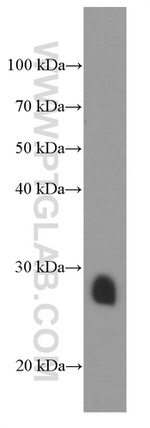 Cardiac Troponin I Antibody in Western Blot (WB)