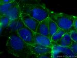 Occludin Antibody in Immunocytochemistry (ICC/IF)