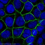 beta-Catenin Antibody in Immunocytochemistry (ICC/IF)