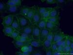 beta-Catenin Antibody in Immunocytochemistry (ICC/IF)