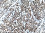 beta-Catenin Antibody in Immunohistochemistry (Paraffin) (IHC (P))