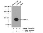 beta-Catenin Antibody in Immunoprecipitation (IP)