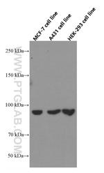 beta-Catenin Antibody in Western Blot (WB)