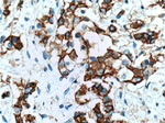 beta-Catenin Antibody in Immunohistochemistry (Paraffin) (IHC (P))